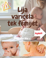 Froika - CALAMINE LOTION