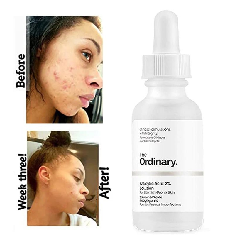 The Ordinary – Salicylic Acid 2% Solution