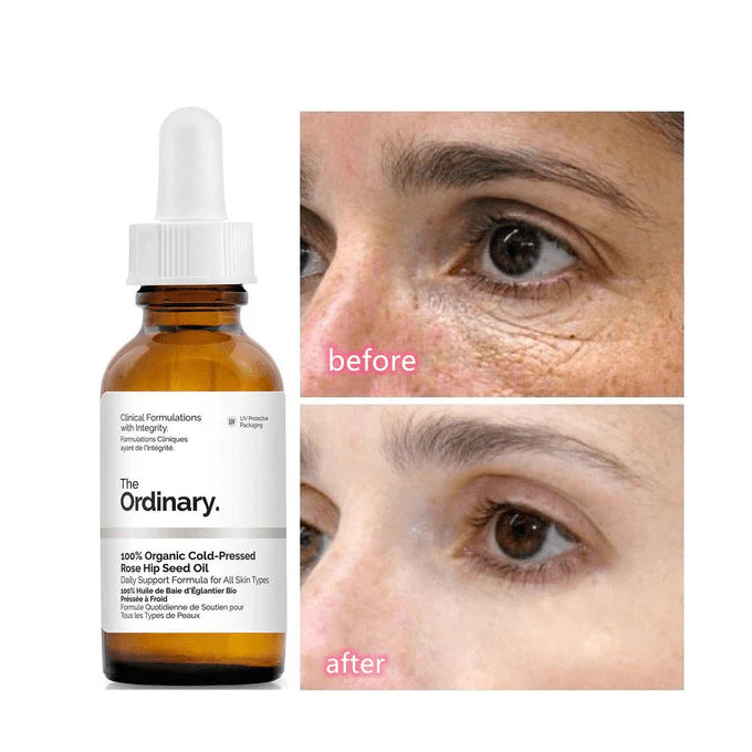 The Ordinary – Caffeine Solution 5% + EGCG 30 ml