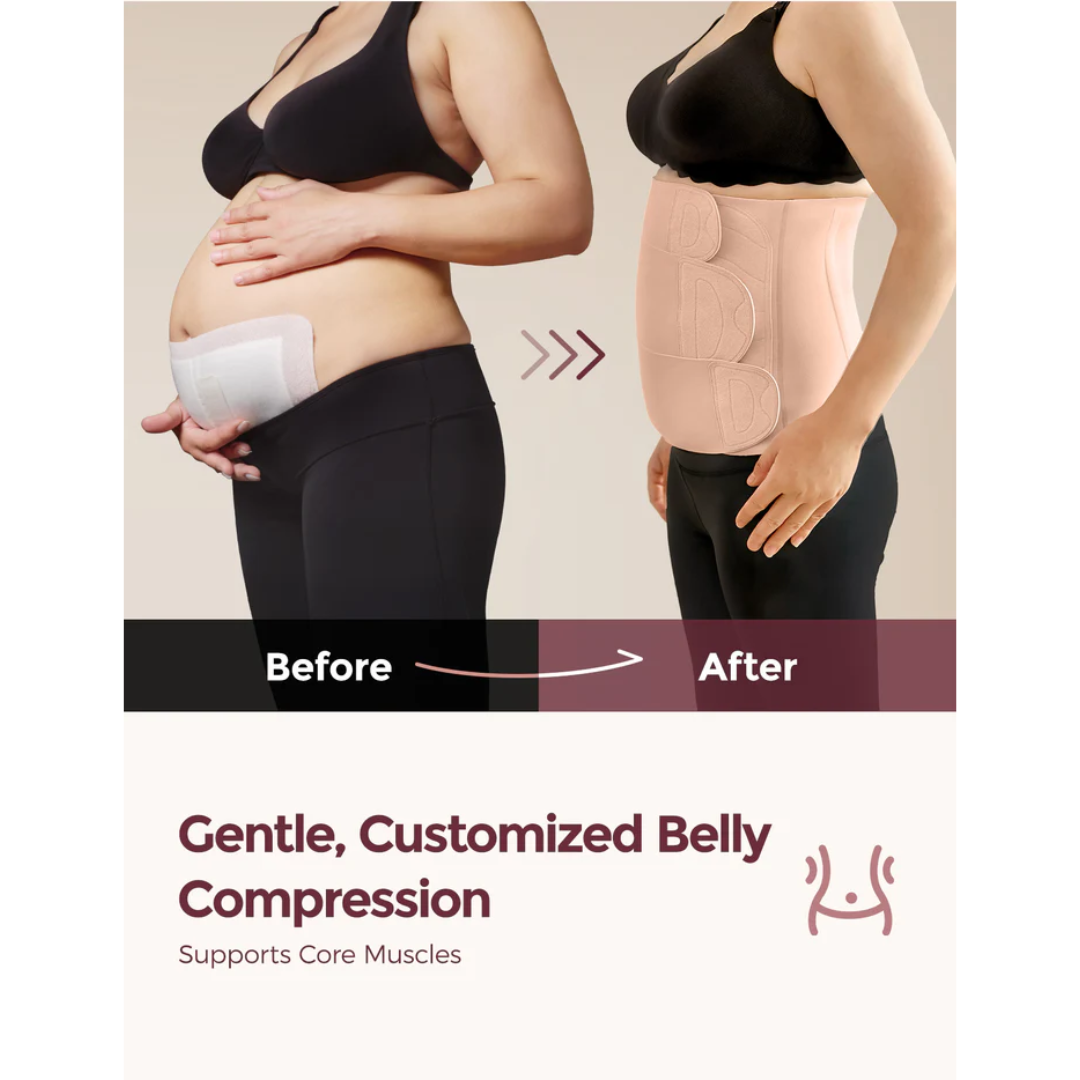 Momcozy - Postpartum Belly Band ( brez pas lindje me 3 ngjitje )