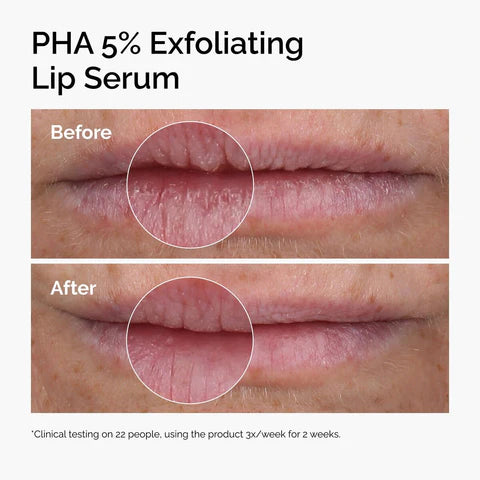 The Ordinary – PHA 5% Exfoliating Lip Serum 15 ml