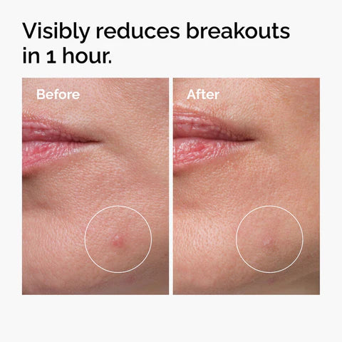 The Ordinary – Sulfur 10% Powder-to-Cream Concentrate 5 g