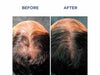 SET PHYTOCYANE MEN Anti-Hair Loss Treatment 12x5ml + Shampoo 100ml Free