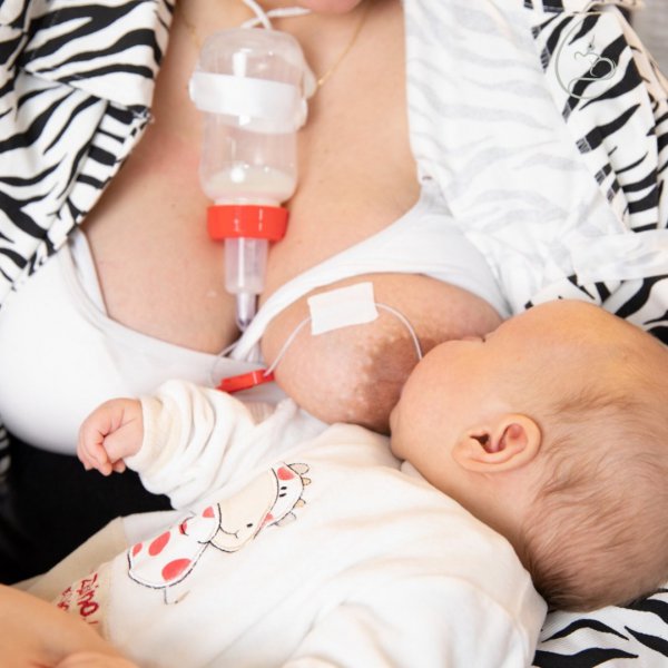 Sistemi mbështetës i ushqyerjes me gji