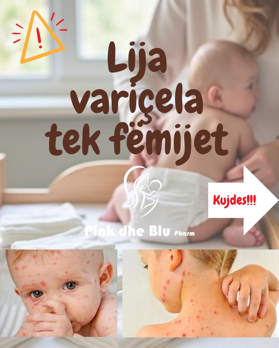 Froika - CALAMINE LOTION