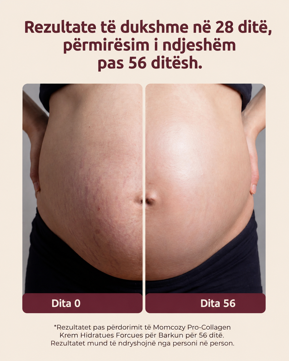 Momcozy Pro-Collagen Belly Firming Moisturizer 150g (krem per strijat)