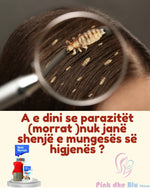 Nurse harveys NOBIT spray kunder paraziteve te kokes