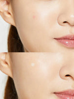 COSRX Acne Pimple Master Patch – Ngjitëse Hidrokoloide për Akne