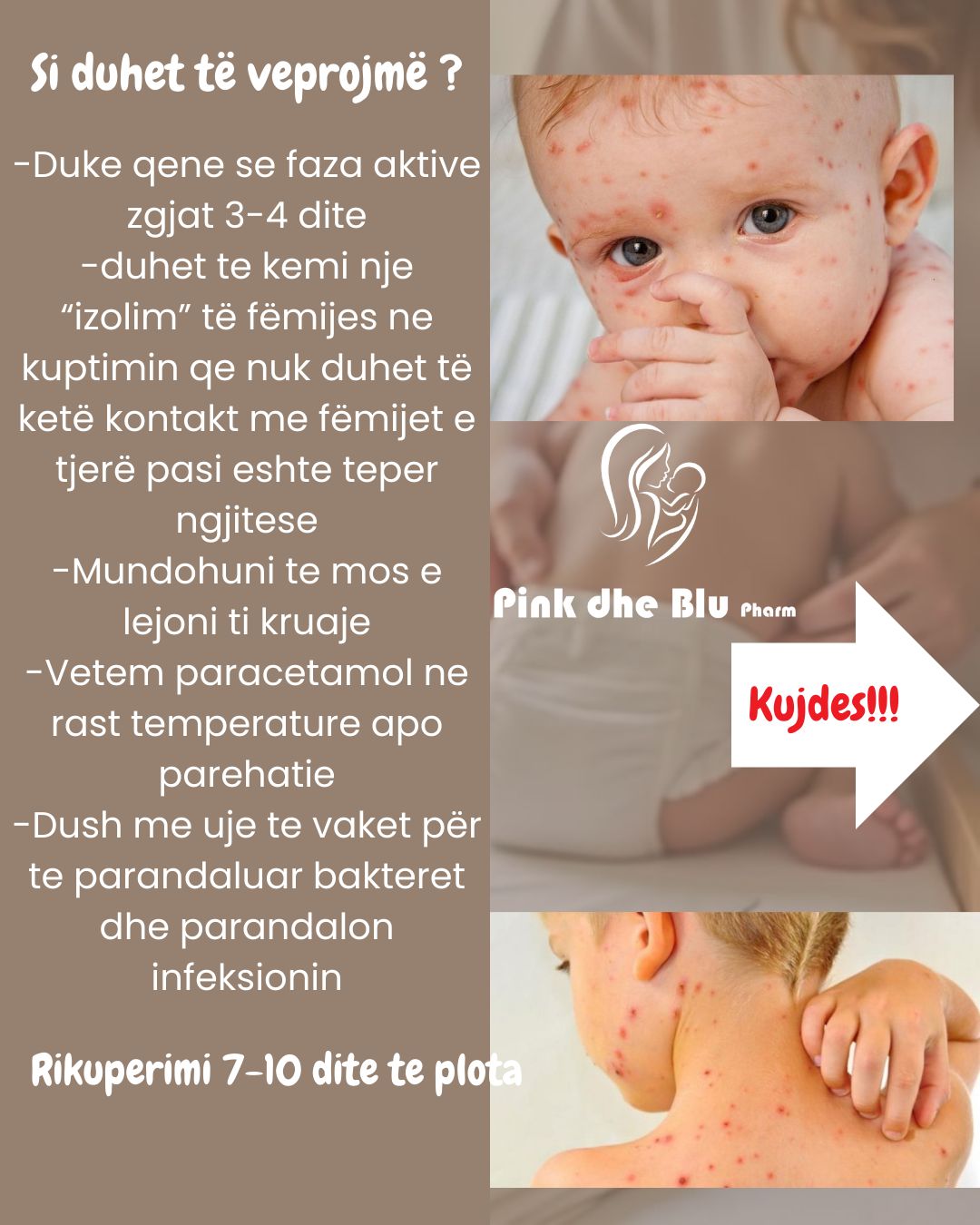 Froika - CALAMINE LOTION