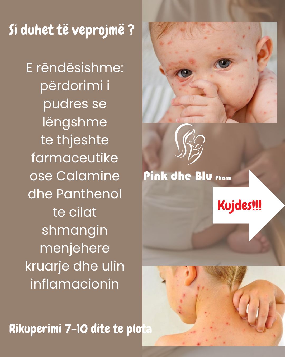 Froika - CALAMINE LOTION